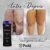 NAUTILUS COLLAGEN GEL - Imagem 3